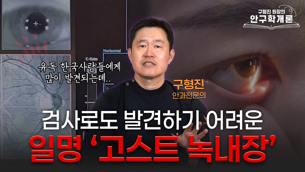 [안구학개론] 발견하기가 쉽지 않은 '정상안압 녹내장'