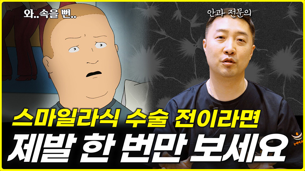 스마일라식 수술 하루 전에 꼭 봐야할 영상 [Q&A 모음]