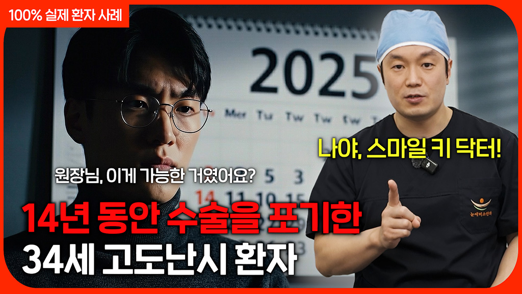 고도난시로 14년 동안 수술을 포기한 34세 남성 | 비전가이드 프로그램 | 고난도 시력교정 클리닉